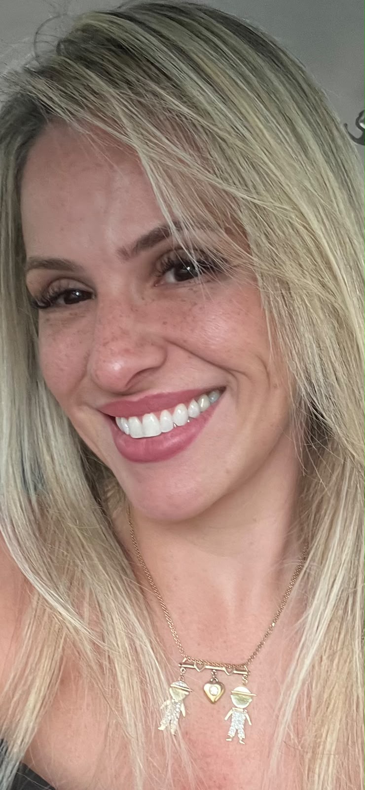Detalhe do sorriso da Dra. Vanessa Araújo